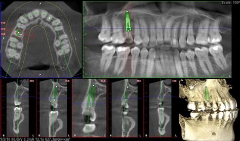 3D Imaging (Dental CBCT) - COSMO DENTAL