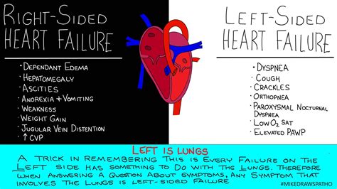 Left Sided Heart Failure: Symptoms, Treatment, And Outlook, 60% OFF