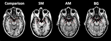 What Makes You Feel Fear? : Shots - Health News : NPR