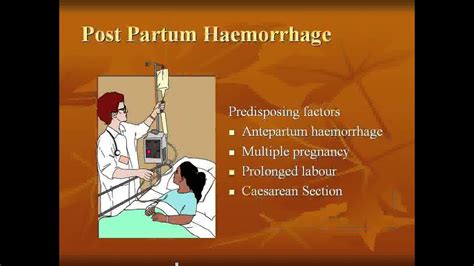 Antepartum haemorrhage - YouTube