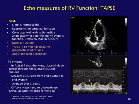 PPT - Role of the Echocardiogram in the Assessment of Pulmonary ...