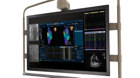 St. Jude Medical Launches Visualization Tool to Improve EP Lab Workflow