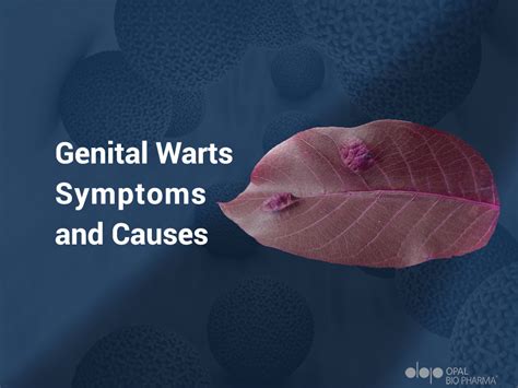 Genital Warts, Symptoms, and Causes - OpalBioPharma