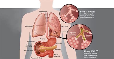 Why Mucus is Actually CRUCIAL For Your Body (and 4 foods that create ...