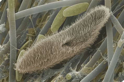 Protozoa - Eukaryotic Microbes