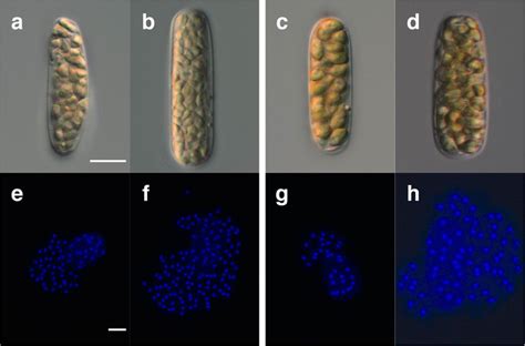 Mature gametangia and DAPI-stained gametic nuclei in each gametangium.:... | Download Scientific ...