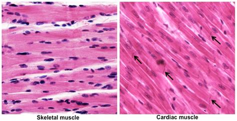 Skeletal Muscle And Cardiac Muscle