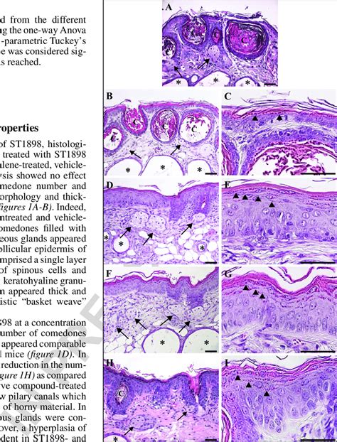 Histological analysis of the skin of rhino mice treated with ST1898. A)... | Download Scientific ...