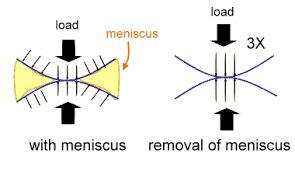 What Is The Function of a Meniscus ? – Howard J. Luks, MD