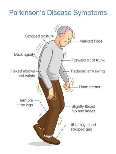 Axovant's Parkinson's Disease Gene Therapy Clinical Trial Launched in UK