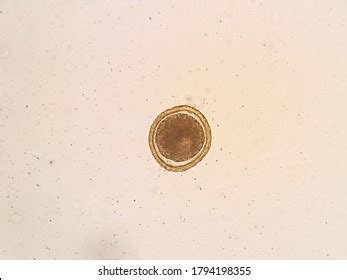 Toxocara Cati Egg Under Microscope Stock Photo 1794198355 | Shutterstock