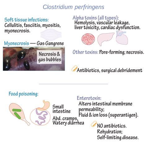 Clostridium - Clostridium difficile - Abioniv - The Reference in ...