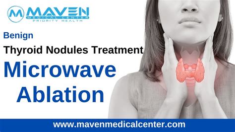 Benign Thyroid Nodules
