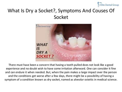 What dry-socket,-symptoms-and-couses