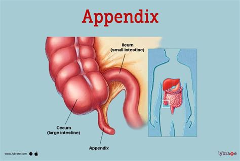 Where Is Your Appendix Located Female Diagram