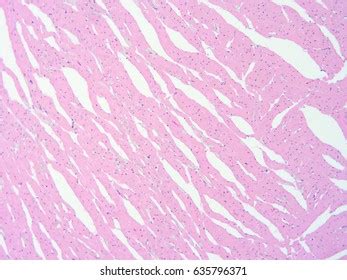 Histology Human Heart Tissue Show Cardiac Stock Photo 635796371 | Shutterstock