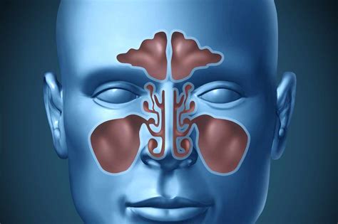 The ENT May Not Be Able to Cure Your Sinus Infection | ENT Buffalo NY