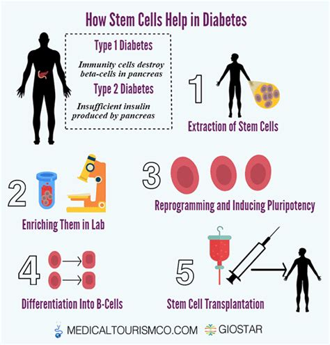 How Do Stem Cells Treat Diabetes - DiabetesWalls