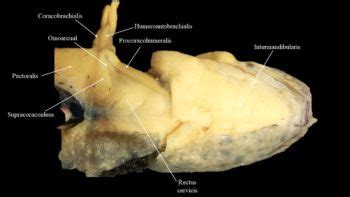 Necturus musculature | Atlas of Comparative Vertebrate Anatomy