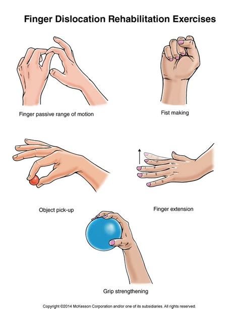 Dislocated Finger Joint Pictures and Treatment | Orthoped