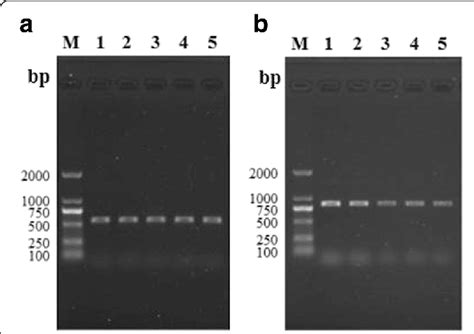 RT-PCR analysis of GAPDH gene a and TspGST gene b at Trichinella... | Download Scientific Diagram