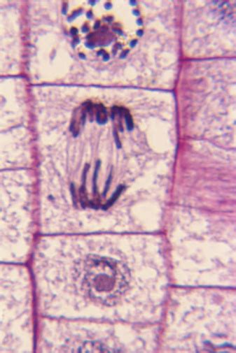 Mitosis Prophase Microscope