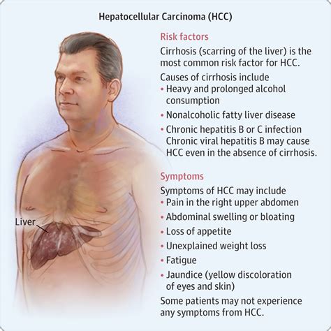 Liver Cancer | Gastroenterology | JAMA | JAMA Network