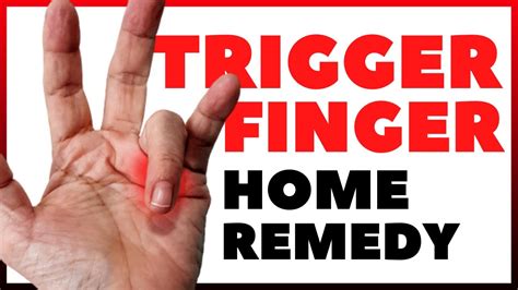 TRIGGER FINGER HOME REMEDY | PHYSICAL THERAPY SESSION - YouTube