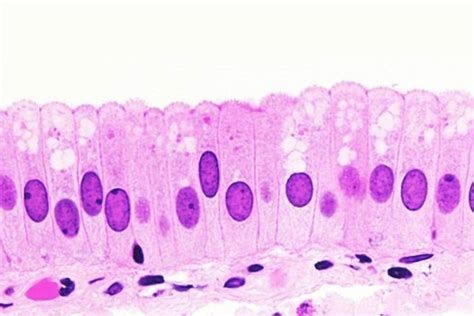 Histología epitelios | 888 jugadas | Quizizz