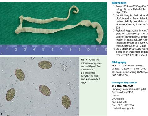 Figure 3 from Multiple colonic aphthoid ulcers caused by ...