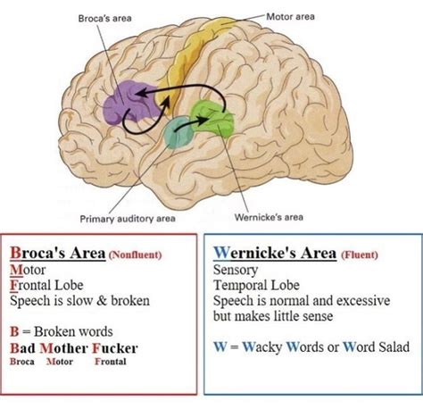 Broca’s vs Wernicke’s | Speech language pathology grad school, Speech ...