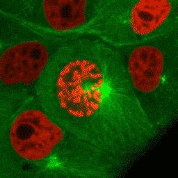 （゚Д゚）IRISA - 無限 - 想像：有糸分裂、ニューロン、およびDNA ... Mitosis Meiosis, Microscopic Photography, Fearfully ...