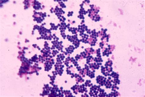 NHỮNG KIẾN THỨC QUAN TRỌNG CẦN NHỚ VỀ STAPHYLOCOCCUS - TỤ CẦU | LABNOTES123