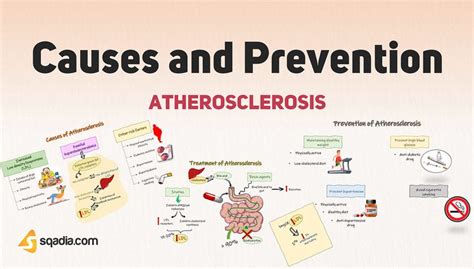 Atherosclerosis - Causes and Prevention