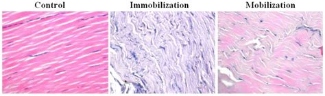 Achilles Tendon Histology