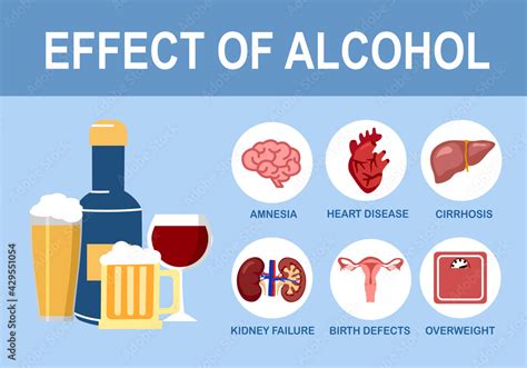 Vecteur Stock Effects of alcohol on human body infographic in flat design. Alcoholism disease ...