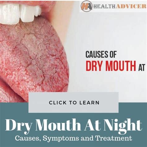 Dry Mouth At Night: Causes, Picture, Symptoms And Treatment