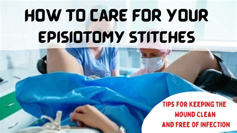 EPISIOTOMY STITCHES || How to keep it clean and infection free #howto # ...