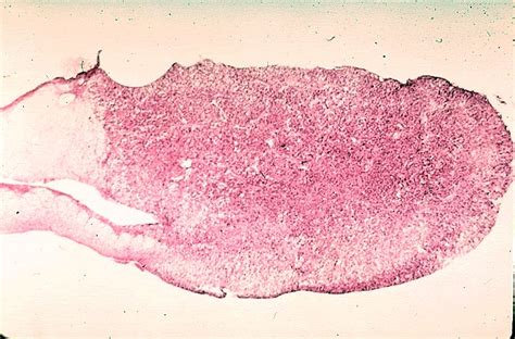 Pineal Gland Histology (full body)