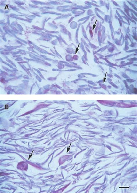 Immunohistochemistry | Download Scientific Diagram