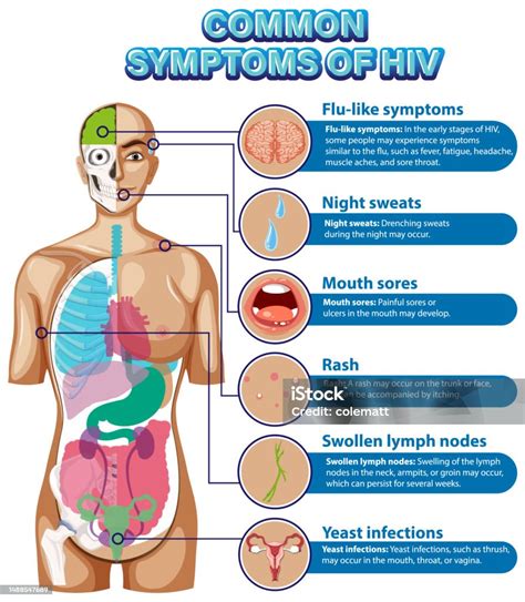 Informative Poster Of Common Symptoms Of Hiv Stock Illustration - Download Image Now - HIV ...