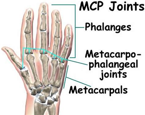 Metacarpophalangeal (MP or MCP) Joint Anatomy - Samarpan