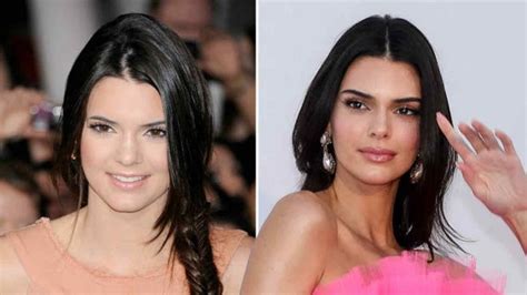 Kardashian-Jenner Sisters: Who Has Had The Most Plastic Surgery?