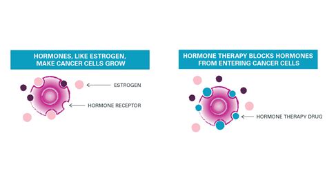 Breast cancer study tests pairing hormone therapy with immunotherapy | Nebraska Medicine Omaha, NE