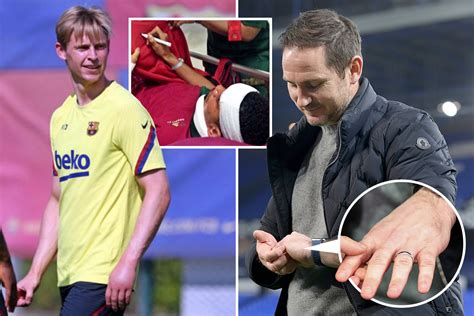 Strangest football injuries from Raphinha kicking fridge to breaking jaw on a carrot and ...