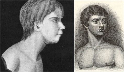 Victor of Aveyron: A feral child who supposedly lived in the French wilderness until he was 12