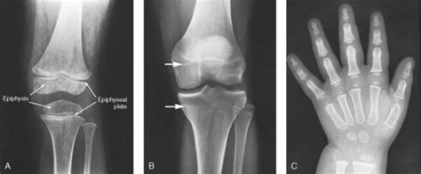 GENERAL ANATOMY AND RADIOGRAPHIC POSITIONING TERMINOLOGY | Radiology Key