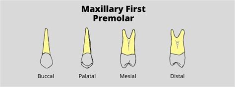 Maxillary First Premolar: Dental Morphology Made Easy | Dental ...