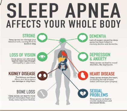 Symptoms of Sleep Apnea: Signs You Need a… | Schneck Medical Center