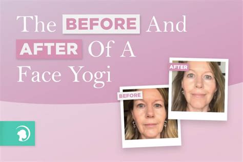 The Before And After: A Face Yoga Success Story